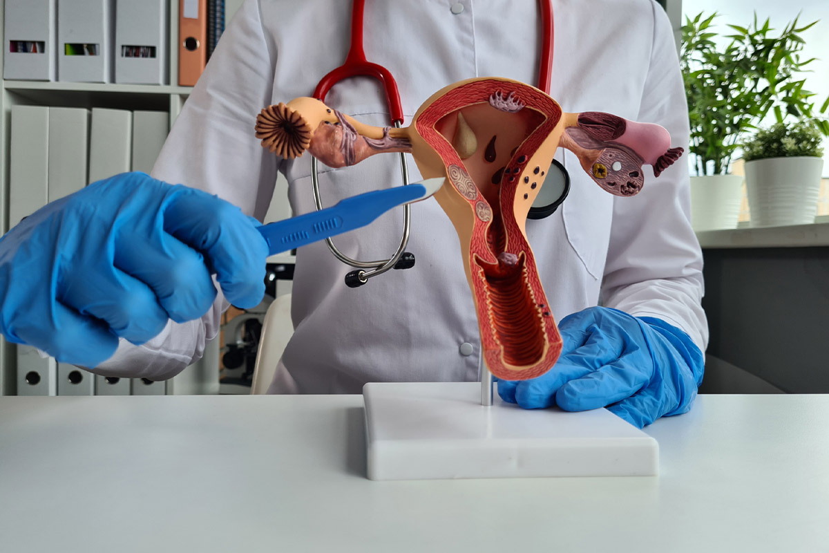gynecological surgery