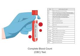 CBC Test Price in Lahore