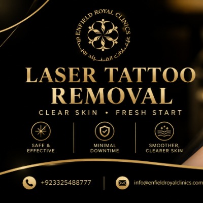 laser tattoo removal